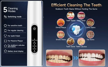 Pet Ultrasonic Teeth Cleaner Puppy Toothbrush Dog Grooming Electric Toothbrush for Tooth Oral Cleaning Pets Dogs Accessories